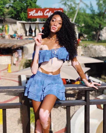 Winnie Harlow 