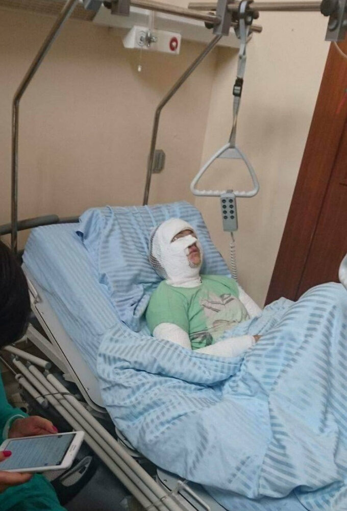 Katarzyna Dacyszyn ucierpiała w wyniku ataku stalkera