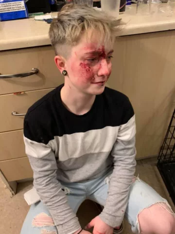 Charlie Graham po pobiciu 