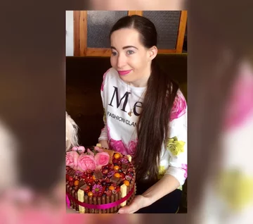 Kobieta ma zespół wad wrodzonych, zwany Zespołem Goldenhara 