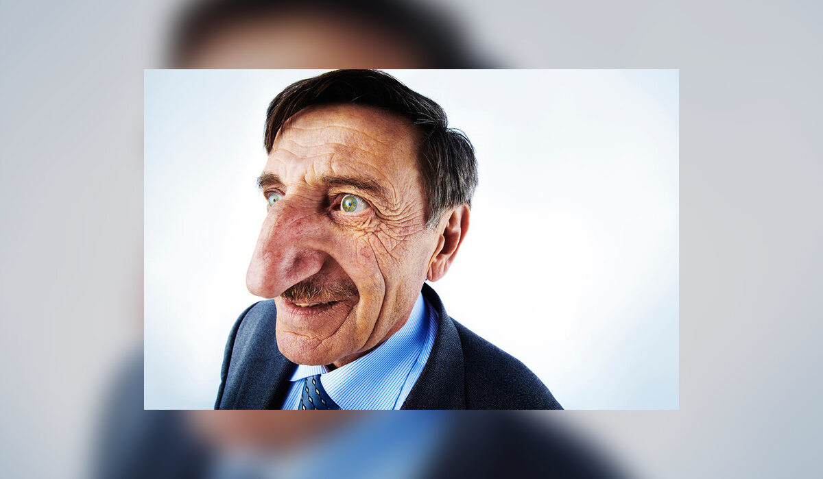 Największy nos Najdłuższy nos ma 8,8 cm i należy do Mehmet Özyürek (Turcja).