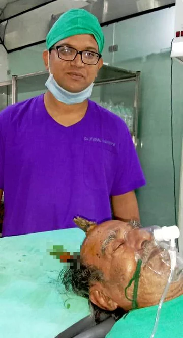 Hindus Shyam Lal Yadav miał na głowie 10 cm róg 