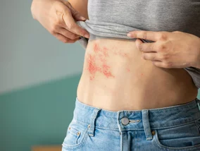 Miniatura: Narażony jest każdy dorosły, konsekwencje...