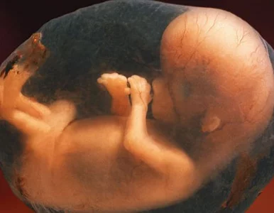 Miniatura: Czermiński: Eugenikę czas zacząć