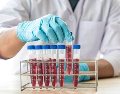 Eksperci: rzadkie choroby hematologiczne wciąż są wyzwaniem dla medycyny