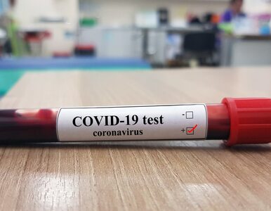 Miniatura: Darmowy test na koronawirusa z dowodem...