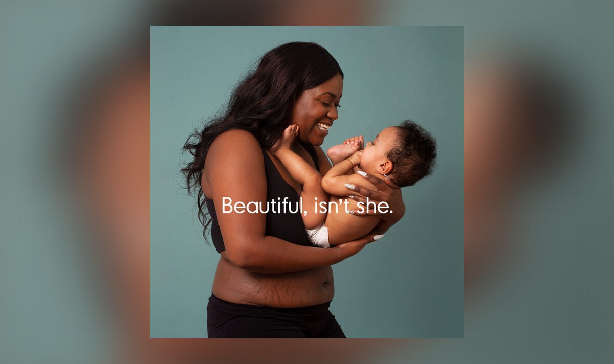 Kobiety pokazują, jak ciąża zmieniła ich ciało 
