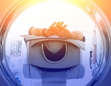 Radioterapia – skutki uboczne. Jakie mogą się pojawić i jak im zapobiec?