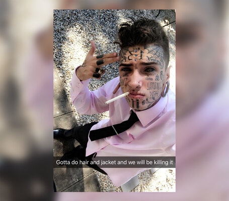 Miniatura: Ethan Bramble przeszedł ponad 40 operacji....