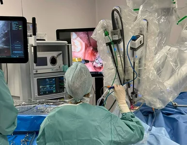 Miniatura: Robot operuje gardło bez skalpela....