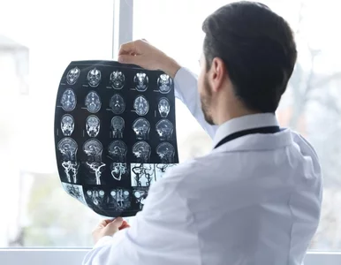 Miniatura: Stwardnienie rozsiane a borelioza. Czy...