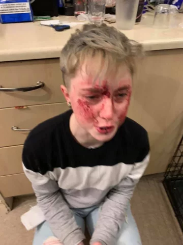 Charlie Graham po pobiciu 