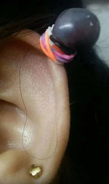 Metoda gumki recepturki 