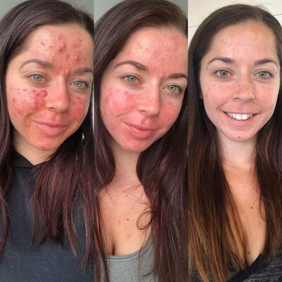 Miniatura: Trenerka personalna pokazała efekty walki...