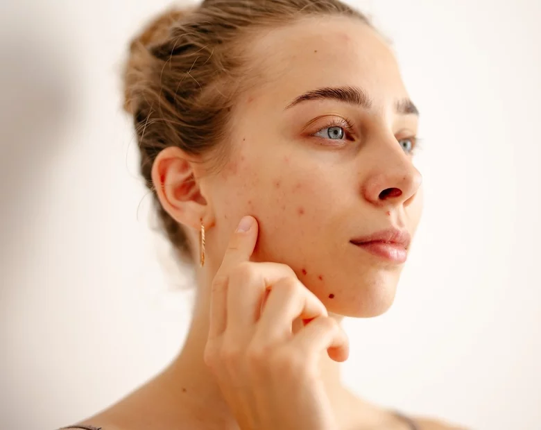 Miniatura: Koreańskie kosmetyki na problemy z cerą –...