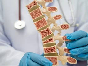 Miniatura: Osteoporoza to nie jest błaha...