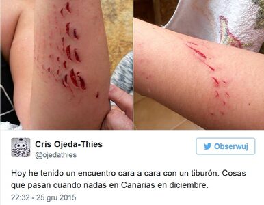 Miniatura: Rekin zaatakował turystkę na Gran Canarii