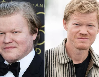 Miniatura: Światła, kamera, Ozempic. Gwiazdy...