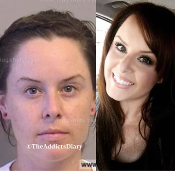 Zdjęcie przed i po wyjściu z nałogu 