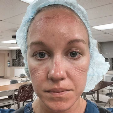 Danielle 