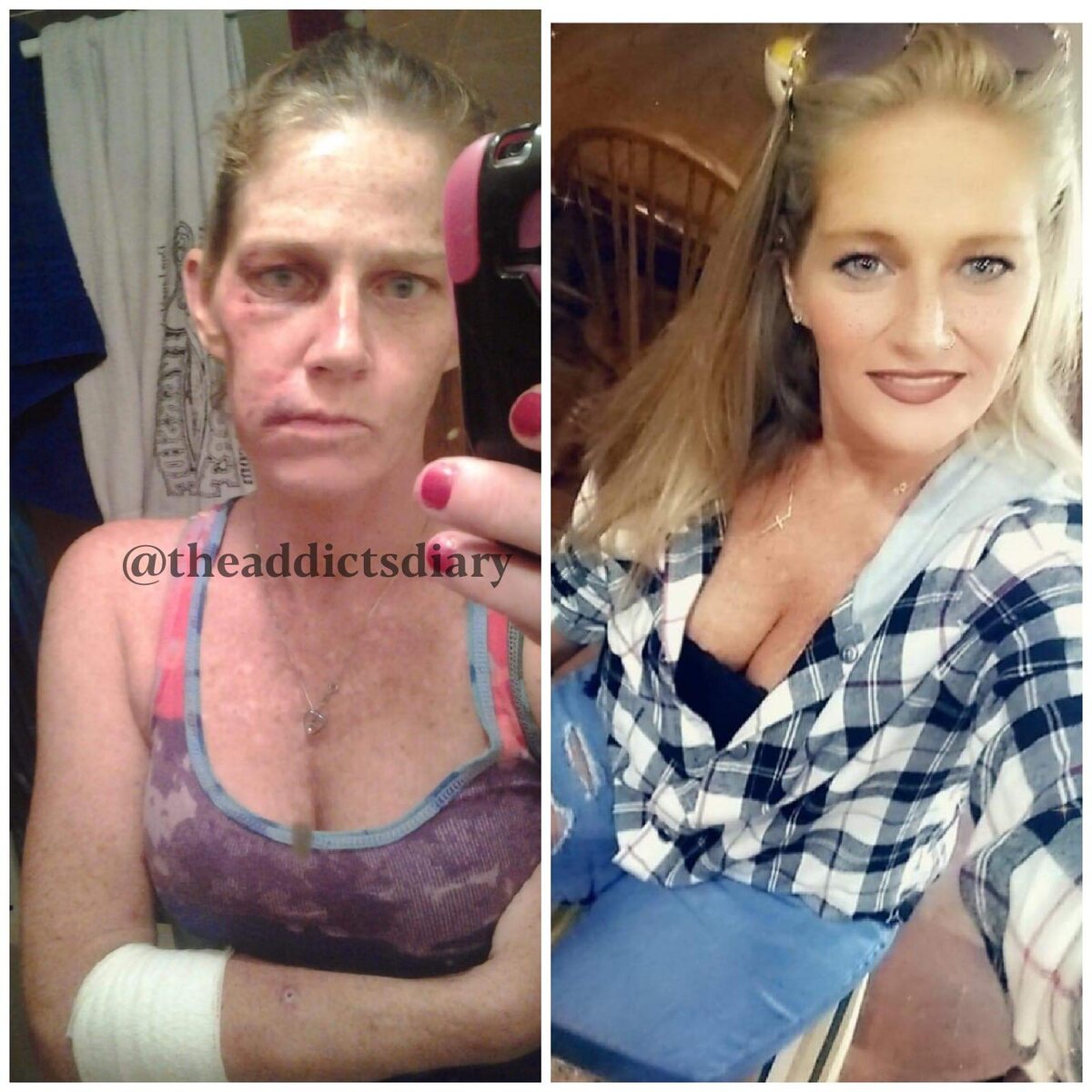 Zdjęcie przed i po wyjściu z nałogu 