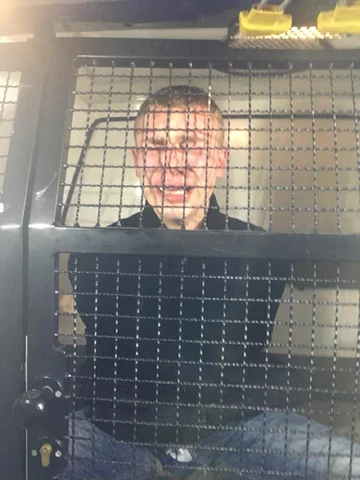 Zdjęcia pobitego 