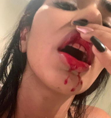 Miniatura: Daniela Cortes twierdzi, że pobił ją...