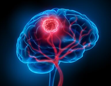 Czy guz mózgu jest wyleczalny?