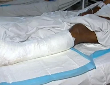 Miniatura: Mężczyzna ze złamaną nogą przeleżał dwa...