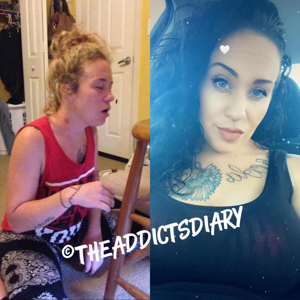 Przed i po odstawieniu narkotyków 
