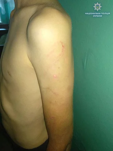 Ojczym maltretował chłopca 