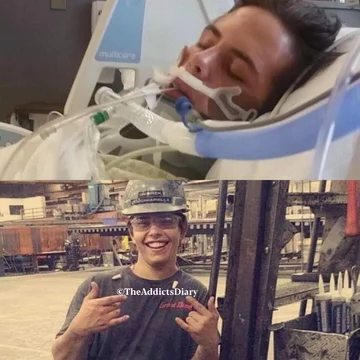 Zdjęcie przed i po wyjściu z nałogu 