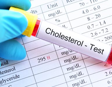 Miniatura: Dobry cholesterol może przyczyniać się do...