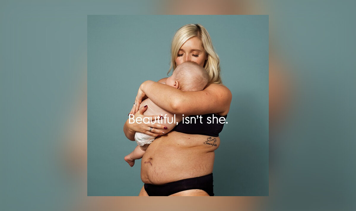 Kobiety pokazują, jak ciąża zmieniła ich ciało 