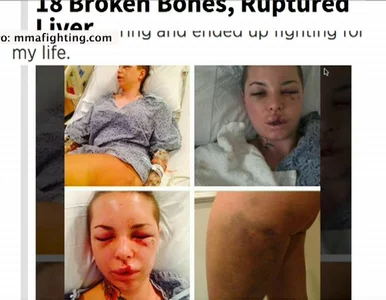 Miniatura: Gwiazda porno pobita przez ukochanego....