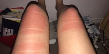 Podarte spodnie i słońce. Oto efekt 