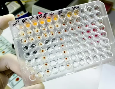 Miniatura: Test ELISA – co to jest, na czym polega,...