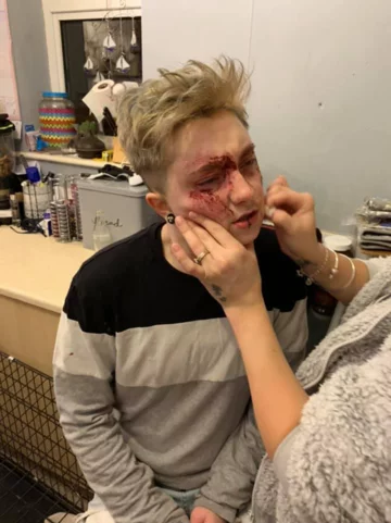 Charlie Graham po pobiciu 