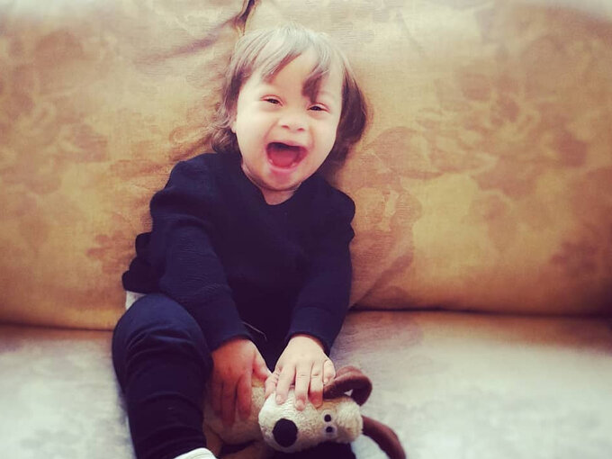 Isla KilpatrickScreaton cierpi na „chorobę Benjamina Buttona” Wprost