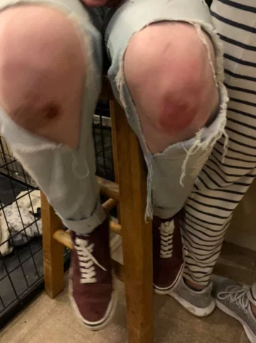 Charlie Graham po pobiciu 