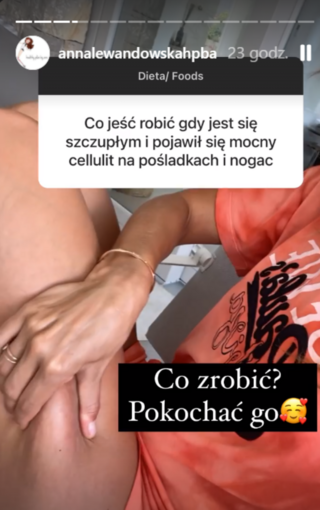 Anna Lewandowska pokazała cellulit
