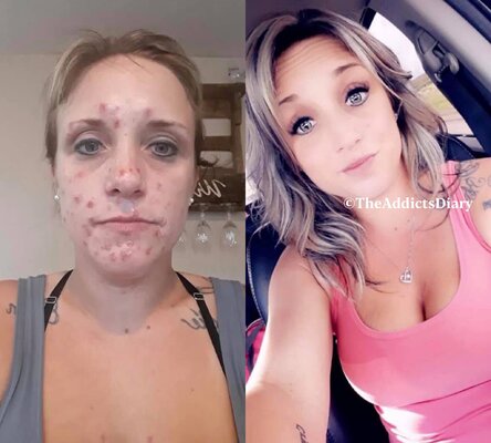 Miniatura: Byli narkomani pokazali swoje zdjęcia...