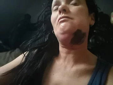 Madelein Carelse cierpi na martwicze zapalenie powięzi 