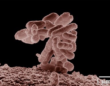 Miniatura: Zakaziłeś się E. coli? To przez brak higieny