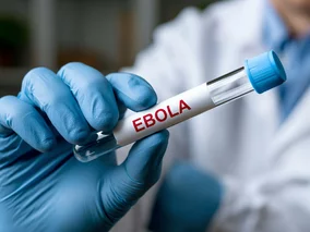 Miniatura: Ebola wróciła do Europy. Czy może pojawić...