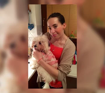 Kobieta ma zespół wad wrodzonych, zwany Zespołem Goldenhara 