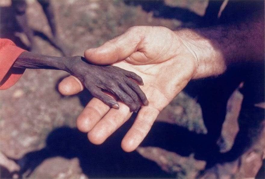 Misjonarz trzyma rękę głodującego dziecka (fot. epicdash.com)