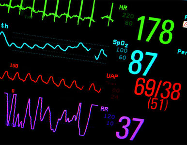 Miniatura: Ile jest warte życie pacjenta? W Polsce...