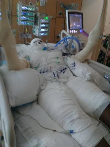 Timiyah Landers w szpitalu 