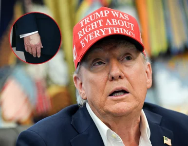 Miniatura: Niepokojące zdjęcia dłoni Trumpa. Biały...